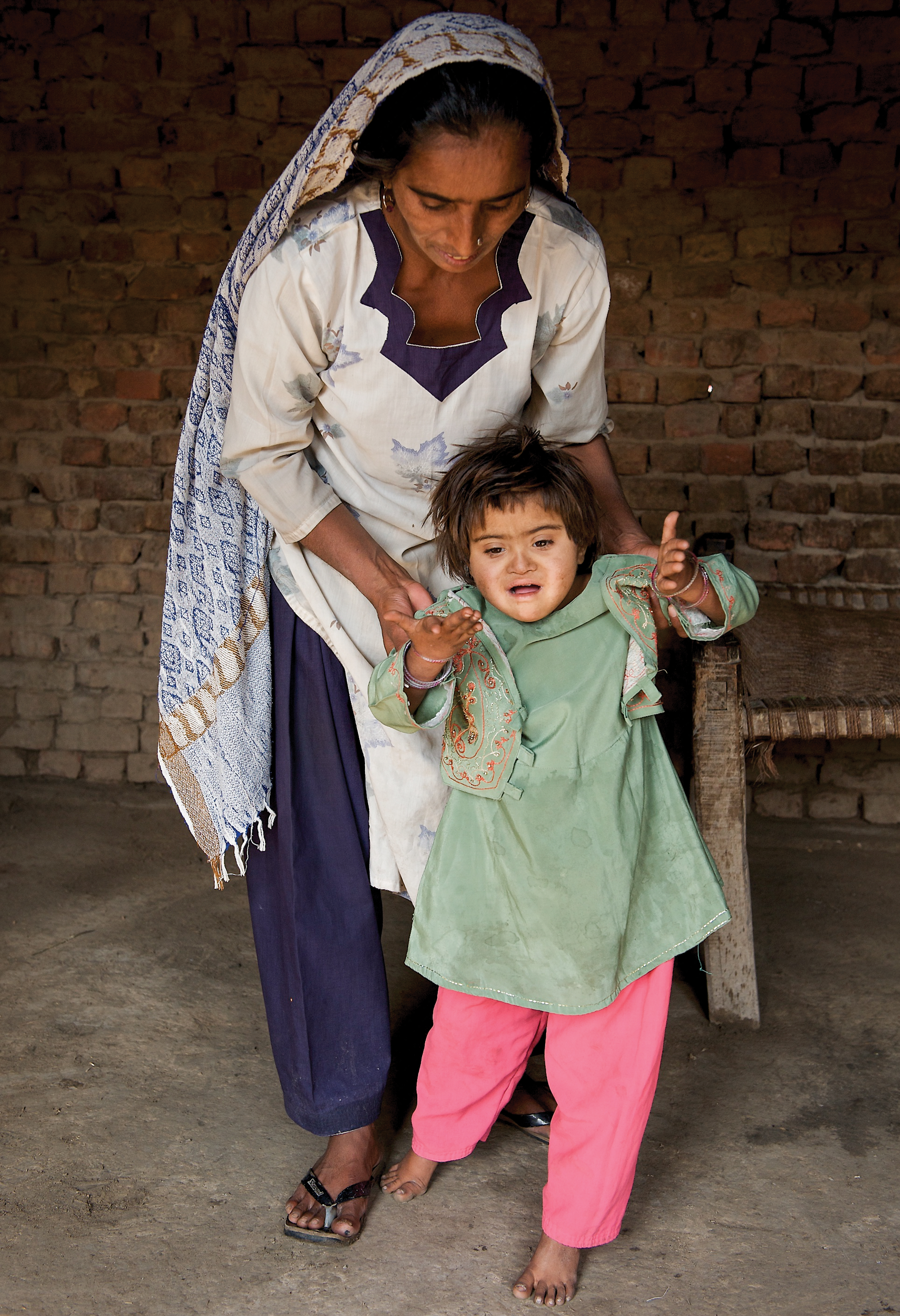 Child walking with polio